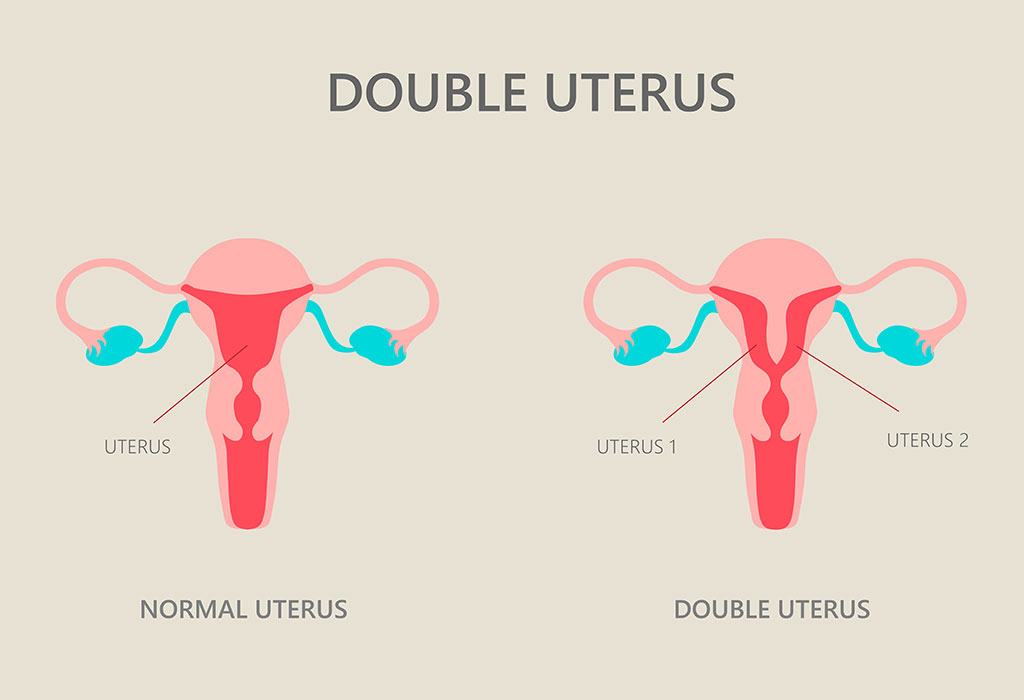 1718497717-double-uterus