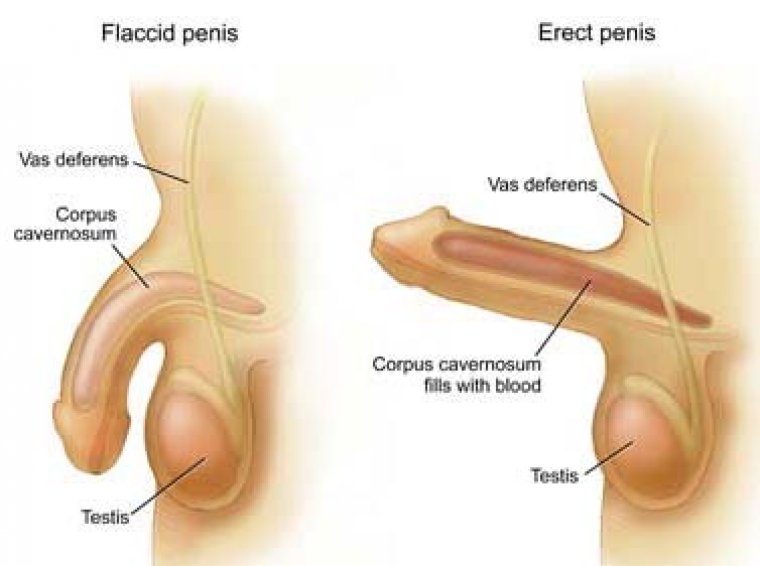 flaccid-and-erect-penis