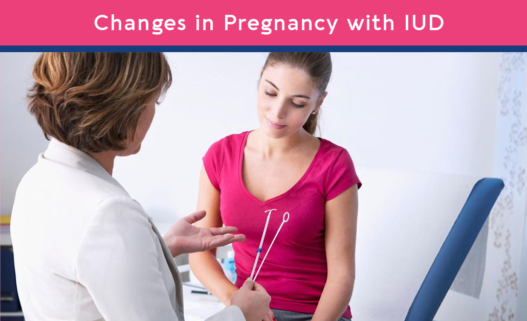 pregnant with IUD